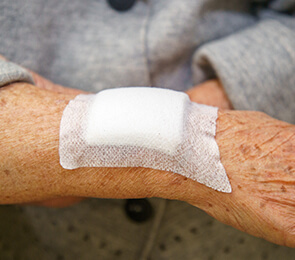 Bedsores In Nursing Homes